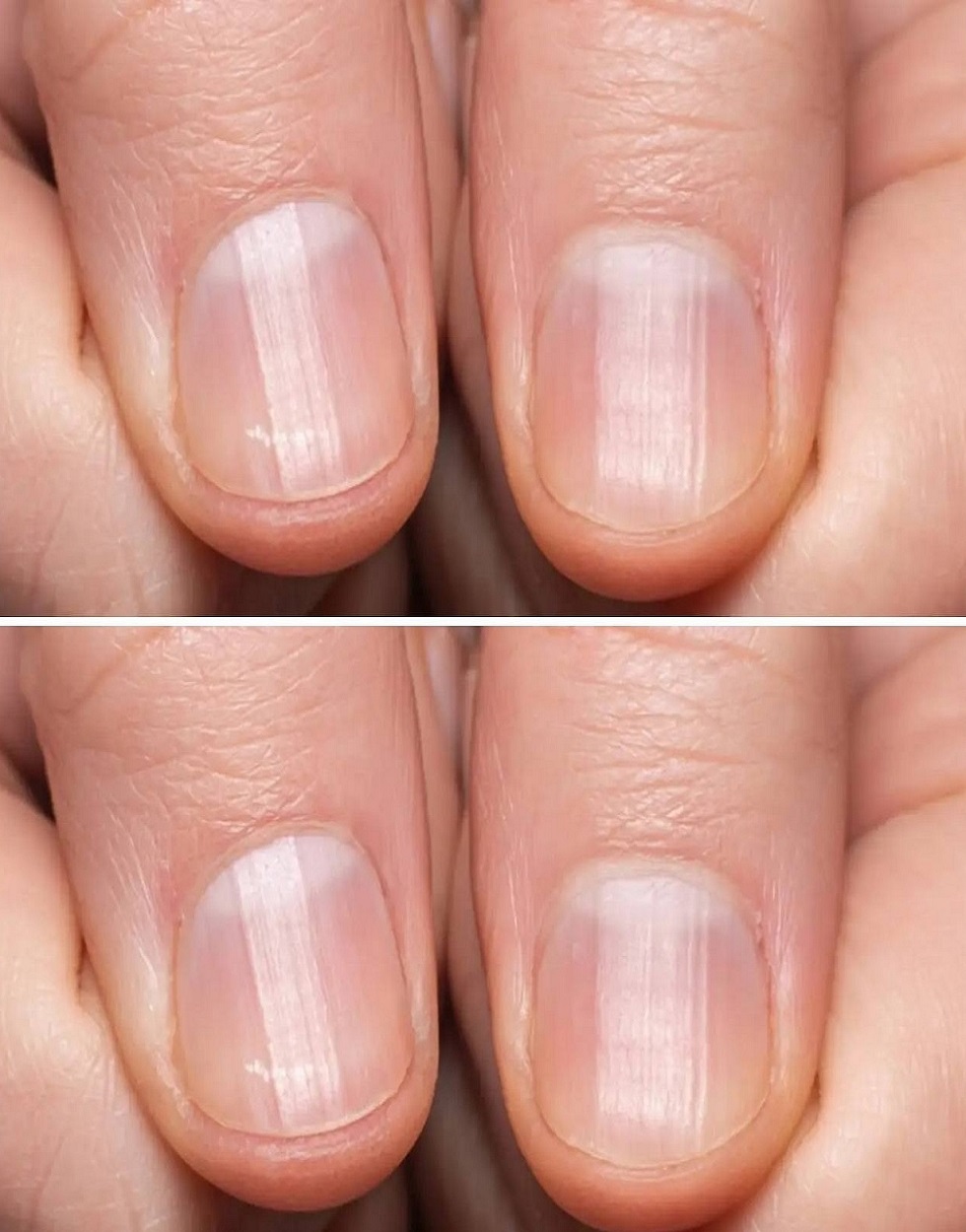 Ce que ces lignes verticales sur vos ongles révèlent réellement pinebox — free download